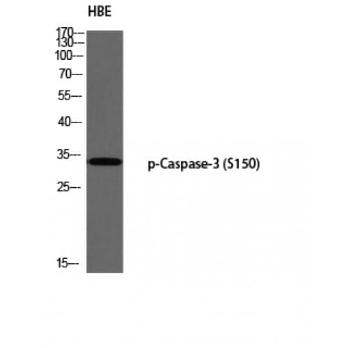 Polyclonal Rabbit anti-Human CASP3 / Caspase 3 Antibody (90-170 aa, IHC, WB)