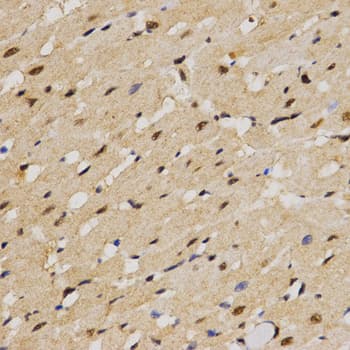 IHC-plus™ Polyclonal Rabbit anti-Human SKIV2L2 Antibody (IHC, WB)
