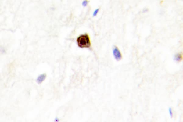 EZH1 / ENX-2 Antibody (Glu192)