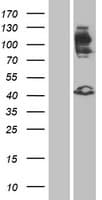 FGFR2 / FGF Receptor 2 Protein (Over-Expression Lysate Myc-DDK (Flag))