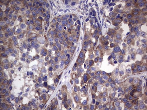 GARS / Glycyl tRNA Synthetase Antibody (clone OTI4H8)