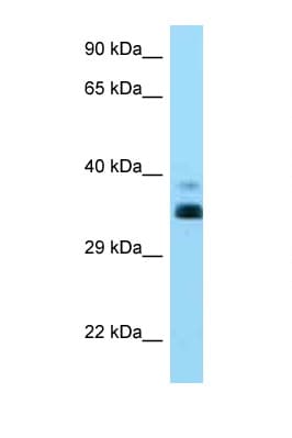 HLA-G Antibody (aa216-265)