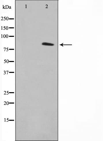 TACC1 Antibody