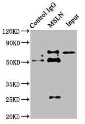 IHC-plus™ MSLN / Mesothelin Antibody (aa 37-598)
