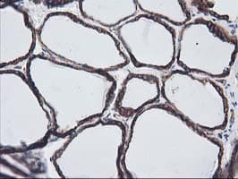 ERGIC-53 / LMAN1 Antibody (clone OTI1E3)