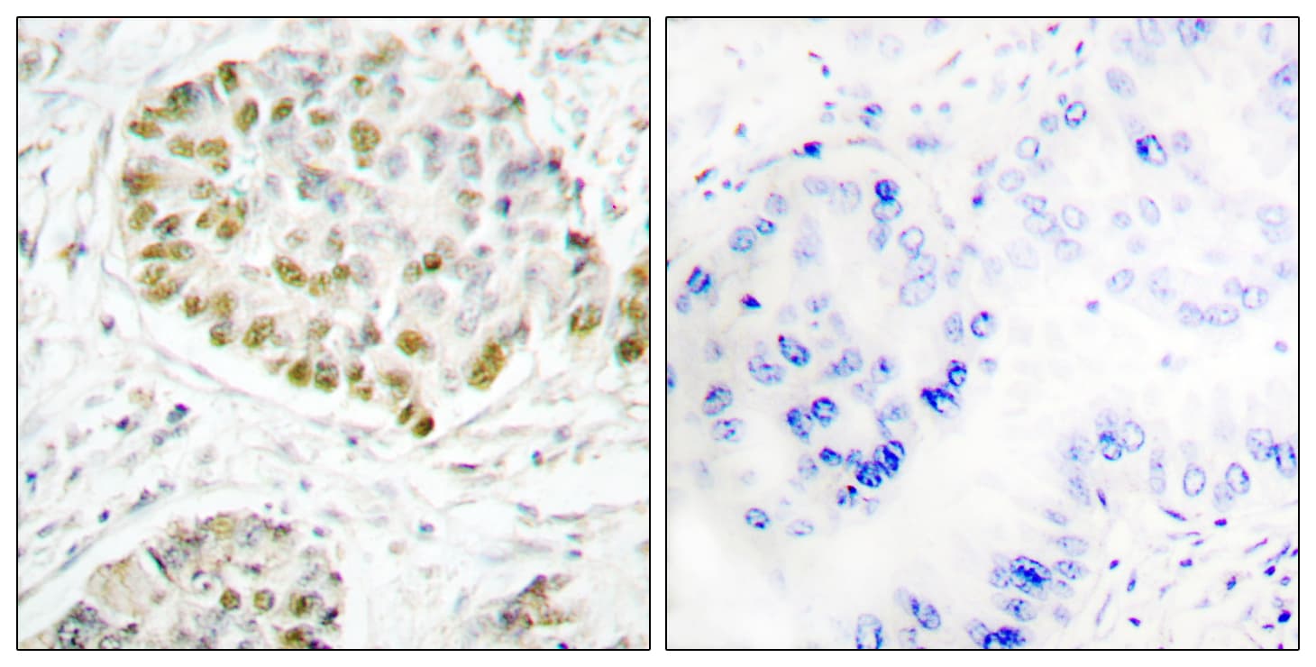 Polyclonal Rabbit anti-Human STAT5A Antibody (aa696-745, IHC)