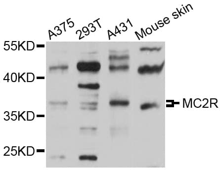 MC2R / ACTHR / ACTH Receptor Antibody