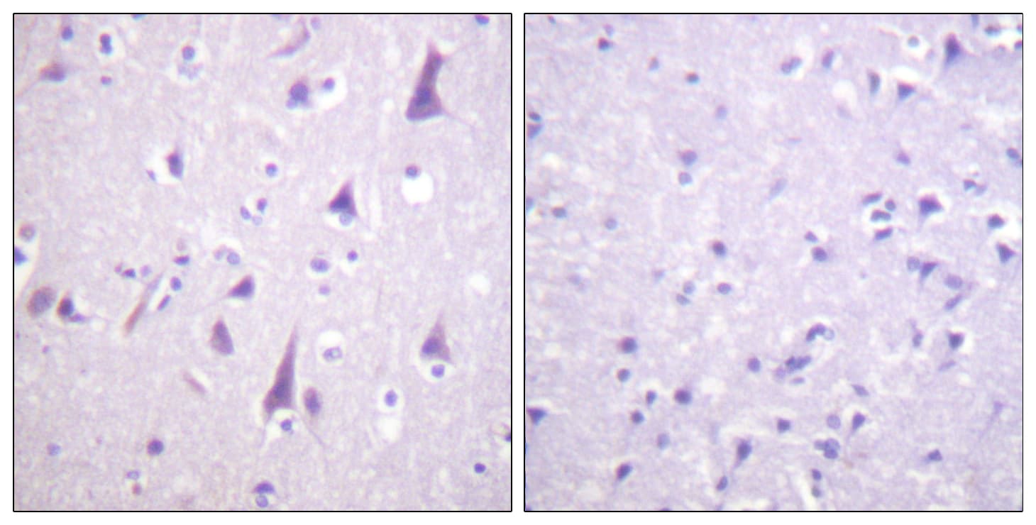 GFAP Antibody (phospho-Ser38)
