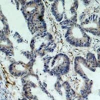 BIRC5 / Survivin Antibody