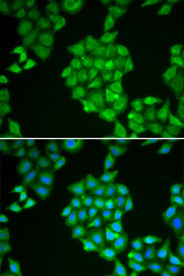 Polyclonal Rabbit anti-Human SPINLW1 / EPPIN Antibody (IHC, IF, WB)