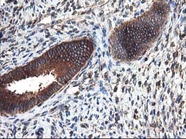 HARS2 Antibody (clone OTI3F1)