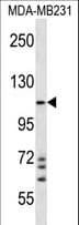 Polyclonal Rabbit anti-Human IPAF / NLRC4 Antibody (aa116-145, WB)