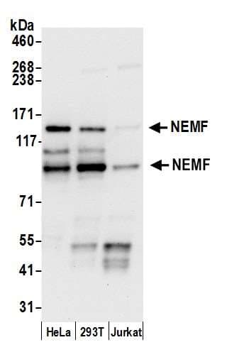SDCCAG1 / NEMF Antibody (aa725-775)