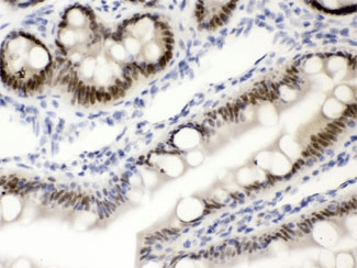 Vitamin D Receptor / VDR Antibody