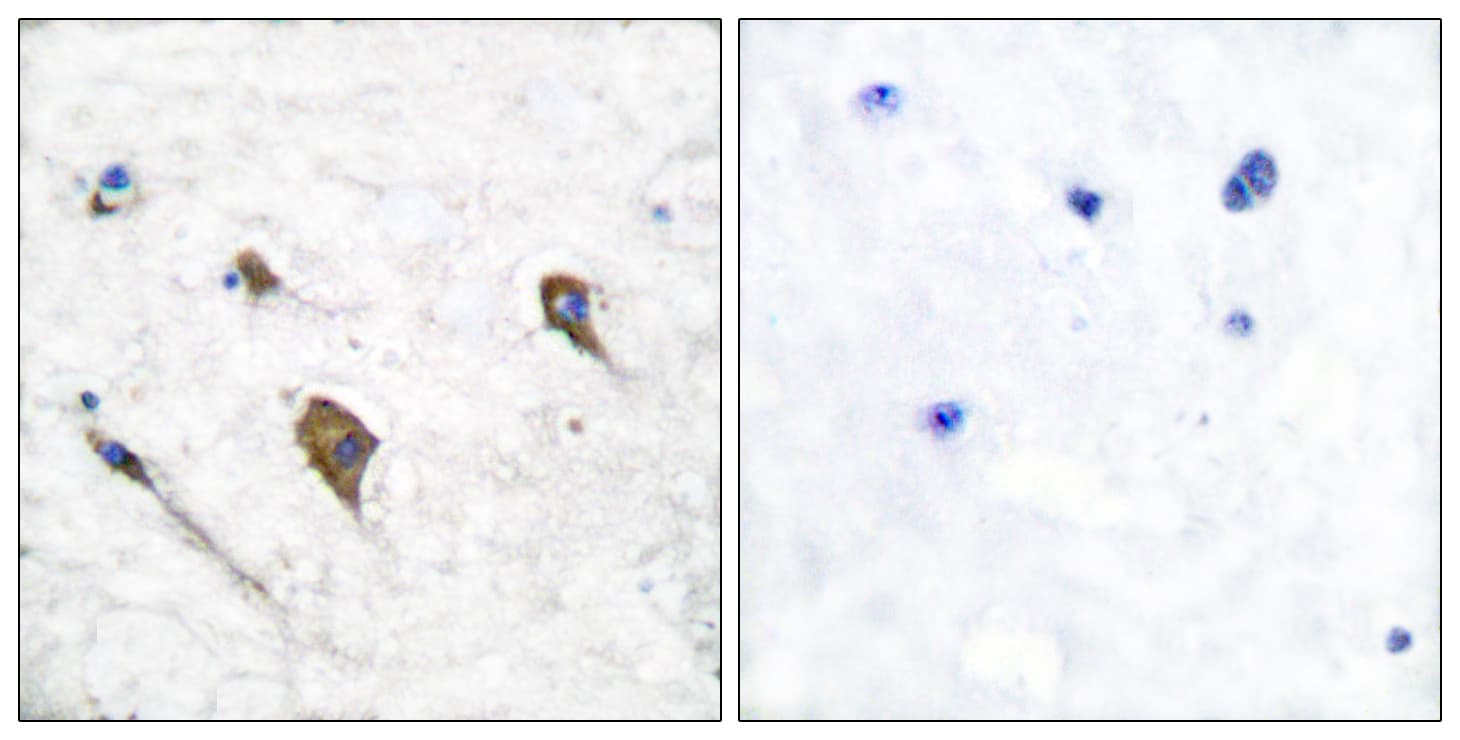 CSF2RB / CD131 Antibody (phospho-Tyr593)