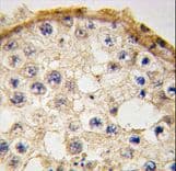 Polyclonal Rabbit anti-Human DDX4 / VASA Antibody (aa554-583, IHC, WB)