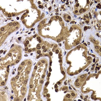 Polyclonal Rabbit anti-Human GPS1 / CSN1 Antibody (IHC, IF, WB)