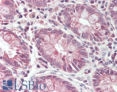 IHC-plus™ FLCN / Folliculin Antibody (aa1-50)