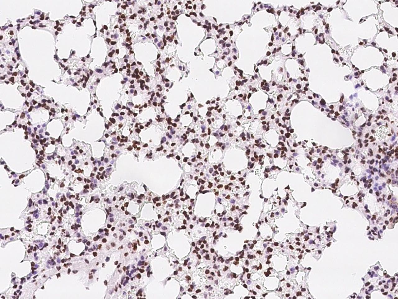 TBX5 Antibody (Preservative Free)