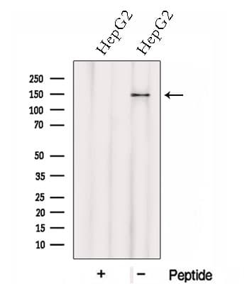 HTATSF1 / TAT-SF1 Antibody