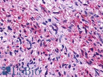 IHC-plus™ ADGRG1 / GPR56 Antibody (Cytoplasmic Domain)