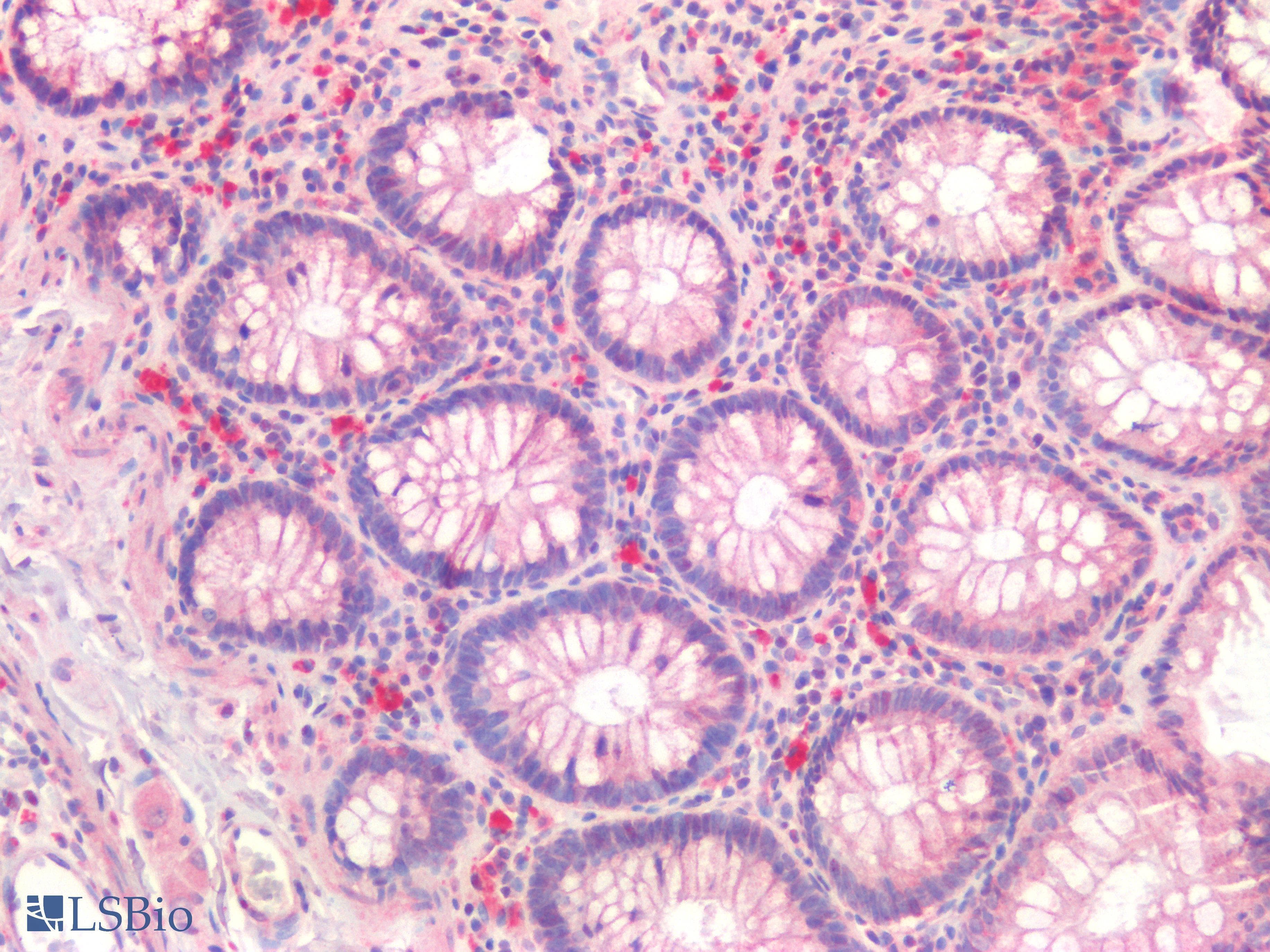 PathPlus™ Osteocalcin Antibody