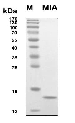 Human MIA / CD-RAP Protein (Recombinant 6His, N-terminus)