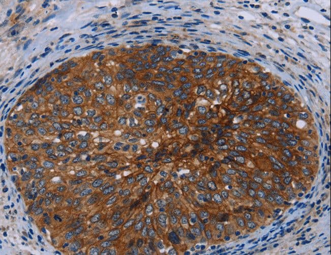 JUP/CTNNG/Junction Plakoglobin Antibody