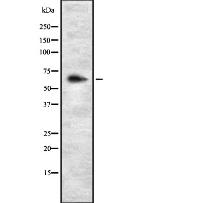 GRN / Granulin Antibody