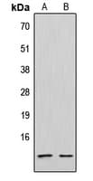 Polyclonal Rabbit anti-Human SDF1 / CXCL12 Antibody (C-Terminus, WB)