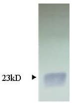 TIMP1 Antibody (Preservative Free, Biotin)