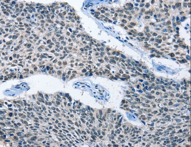 ELAVL1 / HUR Antibody