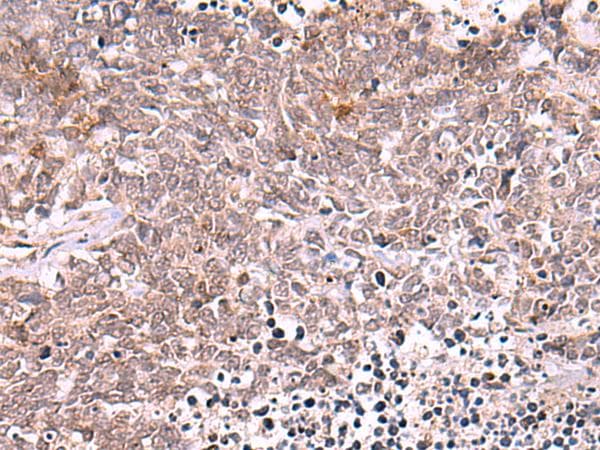 TYW2 / TRMT12 Antibody