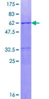 Human MEOX1 Protein (Recombinant GST)