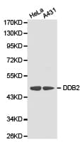 DDB2 Antibody