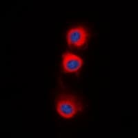 Polyclonal Rabbit anti-Human PP2Ac / PPP2CA Antibody (C-Terminus, IHC, IF, WB)