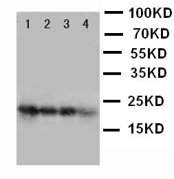 FGF1 / Acidic FGF Antibody (aa16-155)