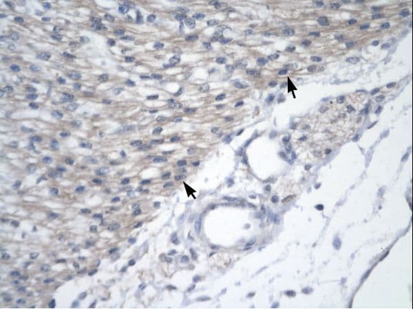 GAS41 Antibody (aa158-207)