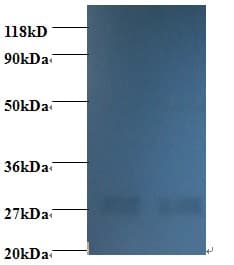 NME1 / NM23 Antibody