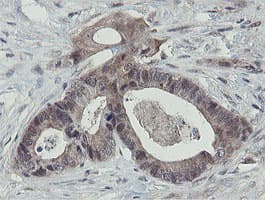 OTUB1 / OTU1 Antibody (clone OTI5B8)