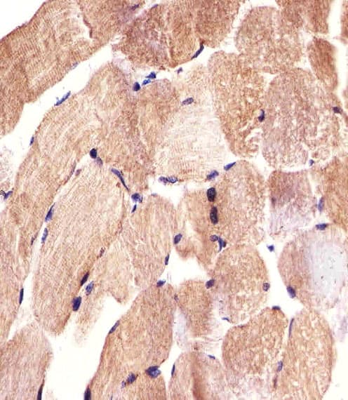 CARD6 Antibody