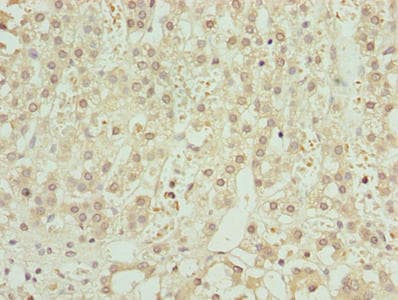 Polyclonal Rabbit anti-Human ZNF821 Antibody (IHC, WB)