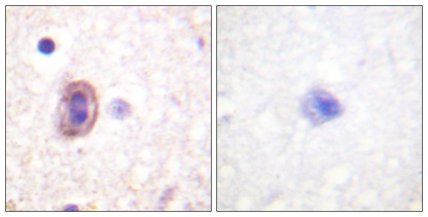 MAP2K4 / MKK4 Antibody (aa223-272)