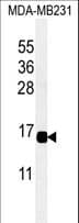 Polyclonal Rabbit anti-Human CXCL9 / MIG Antibody (aa96-122, IHC, WB)