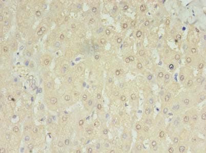 RNMTL1 Antibody