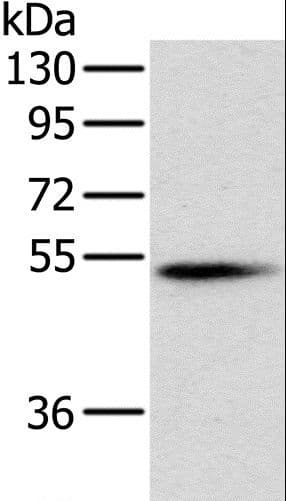 PNLIP / PL / Pancreatic Lipase Antibody