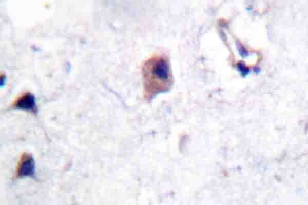 APP / Beta Amyloid Precursor Antibody (phospho-Thr743)