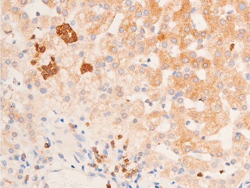Polyclonal Rabbit anti-Human CHEK1 / CHK1 Antibody (phospho-Ser317, IHC, IF, WB)