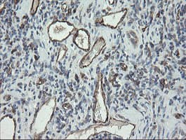 PECAM-1 / CD31 Antibody (clone OTI2C3)