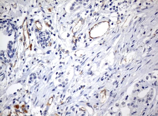 PECAM-1 / CD31 Antibody (clone UMAB32, Carrier-free)